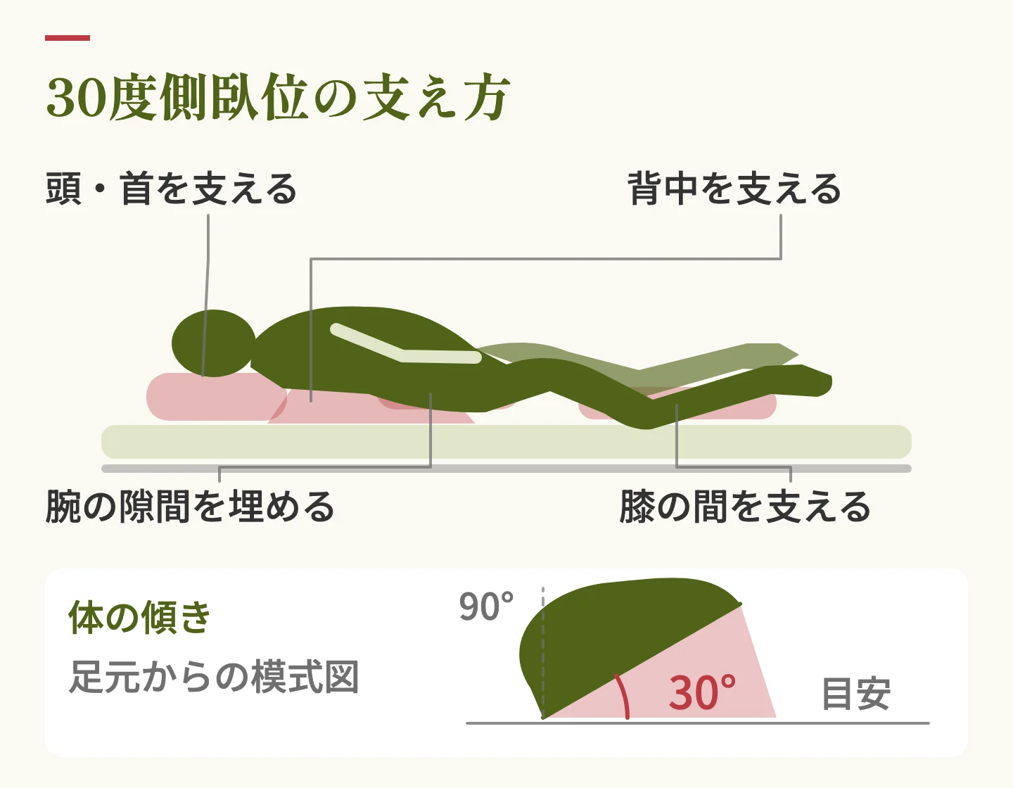 30度側臥位の支え方。背中と膝の間にクッションを入れ、体を30度傾けた状態の図と、足元から見た傾きの模式図